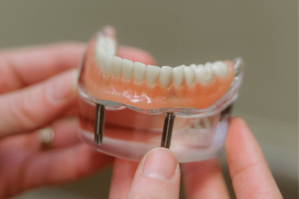Dental Implants Richmond Center for Advanced Dentistry in Richmond, VA